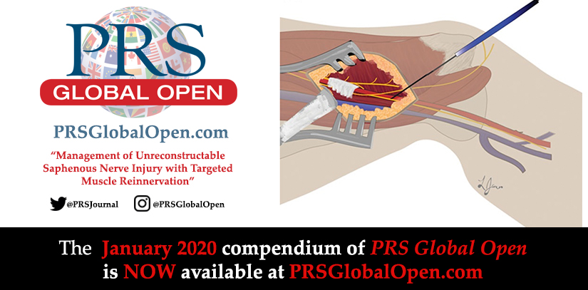 prsjournal's tweet photo. Want to read amazing #PlasticSurgery articles for #FREE? Look no further than the new #PRSGlobalOpen compendium, available now!
You'll find amazing articles, like "Management of Unreconstructable Saphenous #NerveInjury with Targeted #MuscleReinnervation": https://t.co/zJqY9vpEEr https://t.co/atBWINZbqy