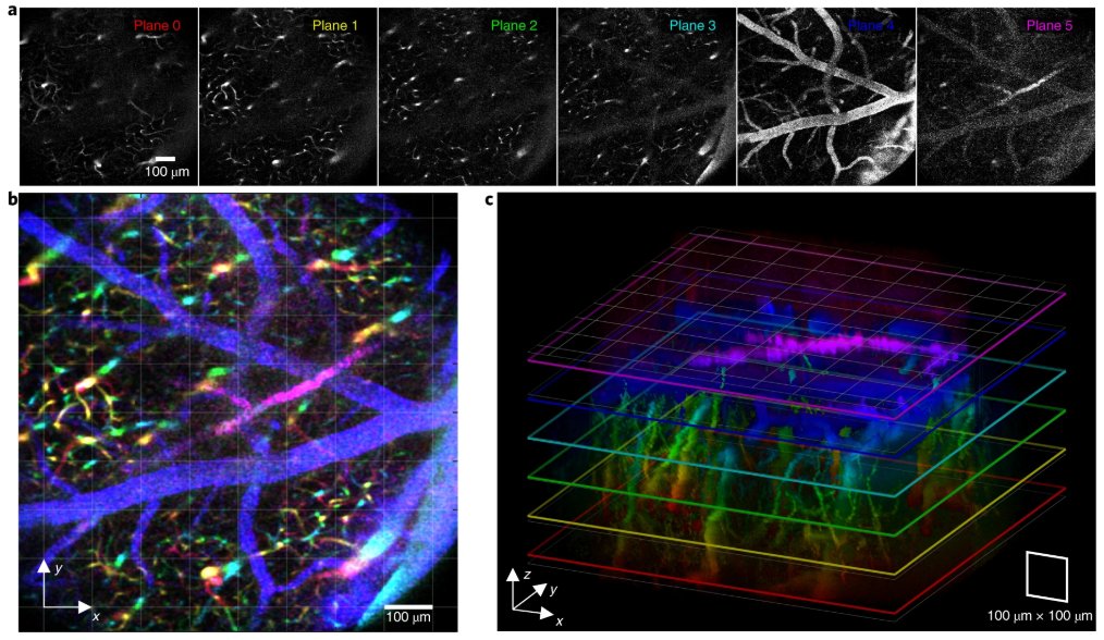 Near-instantaneous axial scanning over large depth ranges with reverberation two-photon microscopy from the Bifano and Mertz labs. nature.com/articles/s4159…