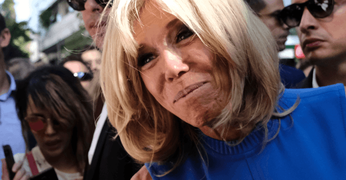 Brigitte macron chirurgie