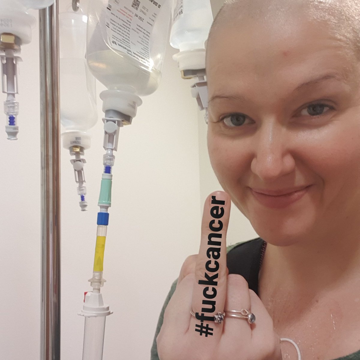 bettyflorence23's tweet photo. Today marks 20 weeks since I was told I had #stage4 #stomachcancer &amp; I didn't have long to live. But today makes 140 days of fighting #cancer &amp; sticking my middle finger up to it! 🖕🏻 #fuckcancer #determined #dyingtobeatcancer #terminallyill #incurablecancer #linitisplastica https://t.co/alb8MqfjOK