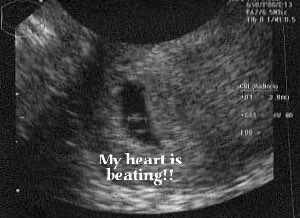 DeityOfTides's tweet photo. This a very special post for a special man. I absolutely love you and I can’t wait to be your wife. I don’t care if you win any more titles or not, just know you will forever have the title of DAD!!! Surprise honey: I’M PREGNANT 🤰 https://t.co/tiKlI0yM4O
