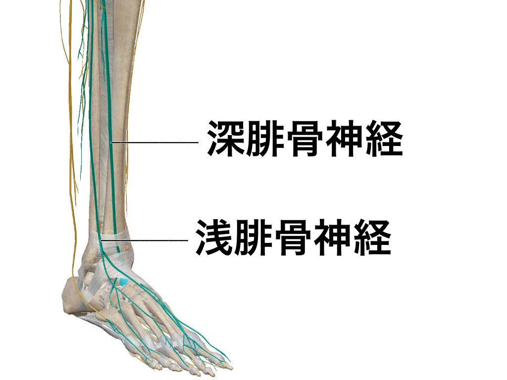一社 日本治療家研究所 Prt療法 思いっきり解剖学 Auf Twitter 腓骨神経麻痺 深腓骨神経 浅腓骨神経はともに 足背を通過します その為 サンダルのストラップや 靴の紐の締めすぎによって絞扼性神経麻痺を 起こす事があります 解剖学 思いっきり解剖学