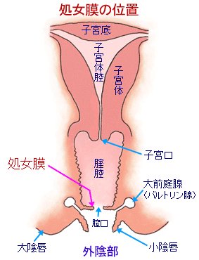 子宮口膣ヒダ  / X