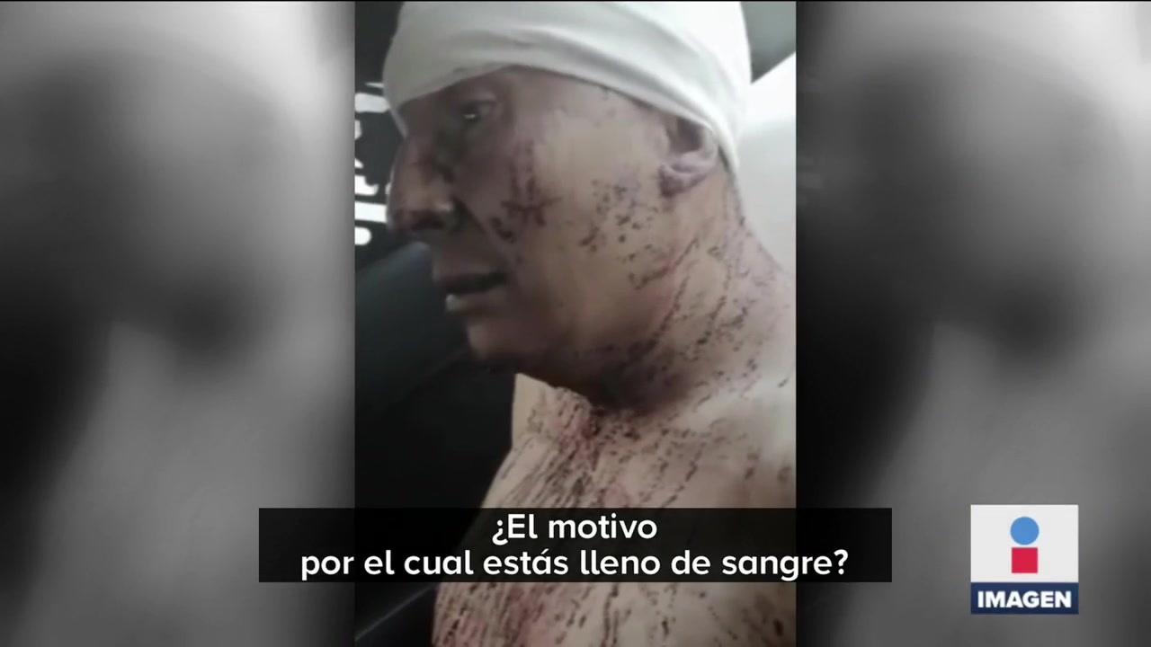 Hombre narra cómo asesinó y desolló a su esposa en la GAM