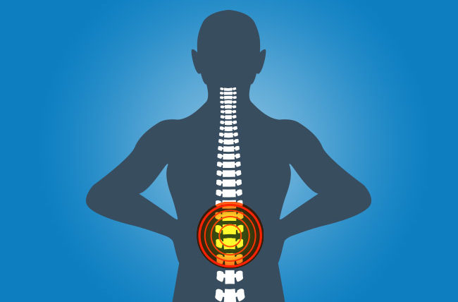 DrSusmitNaskar's tweet photo. ⚫️ Spinal Fractures: Common Cause of Teen #BackPain
▫️
▫️
⚫️ This generation is characterized by its extremely active lifestyle and breakneck pace. The forerunners in this race are teenagers. https://t.co/5cUdvNtSny
▫️
#InvasiveSpineSurgery #SpineSurgery #Sciatica #SlippedDisc https://t.co/ntjZudGZZJ