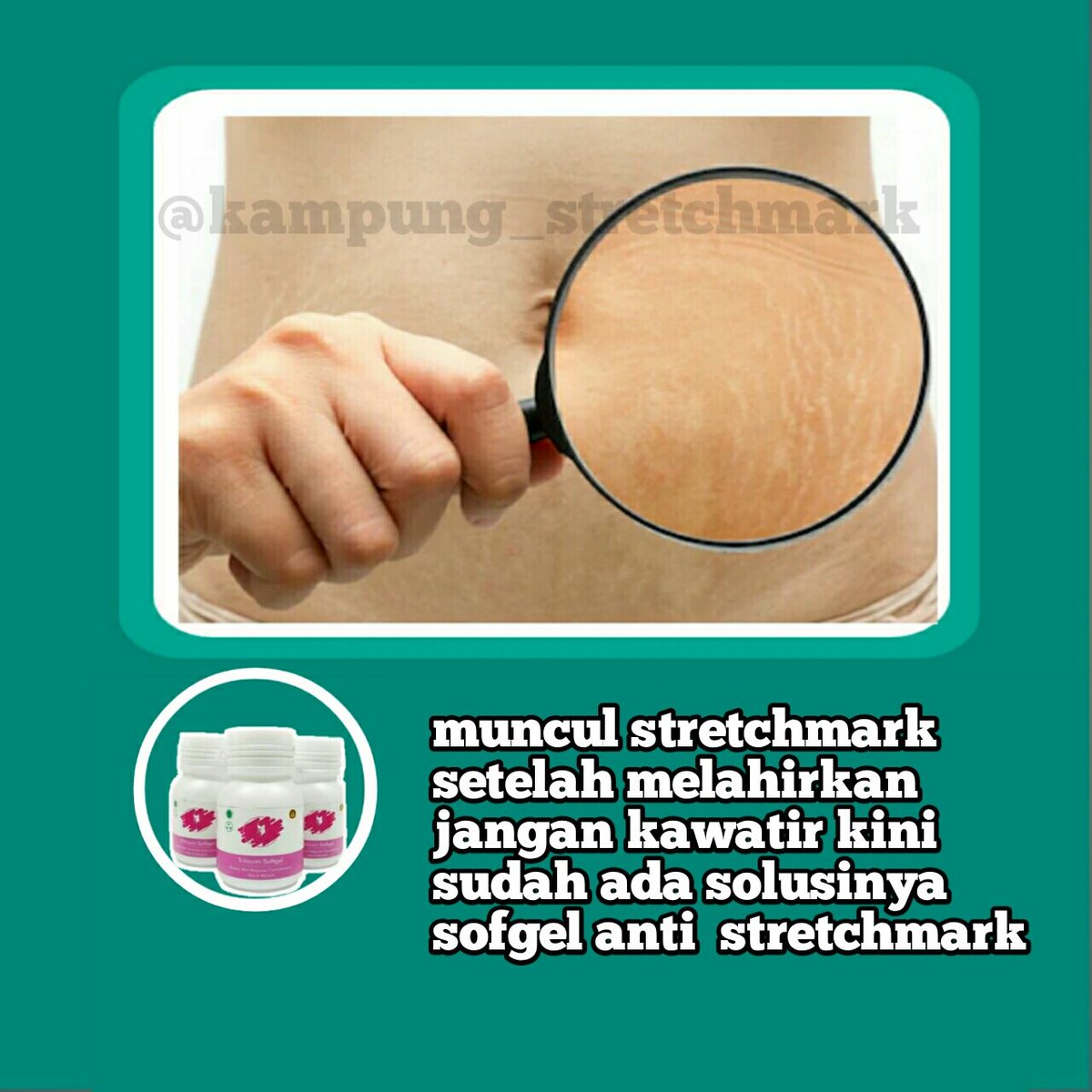 KStretchmark's tweet photo. Buaruan order https://t.co/c4Km6J7vXE