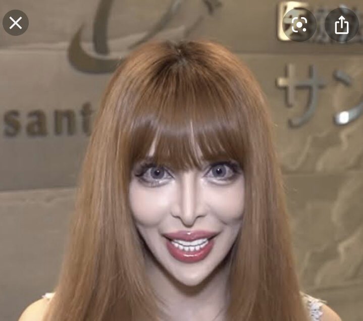 整形モンスター 整形モンスター