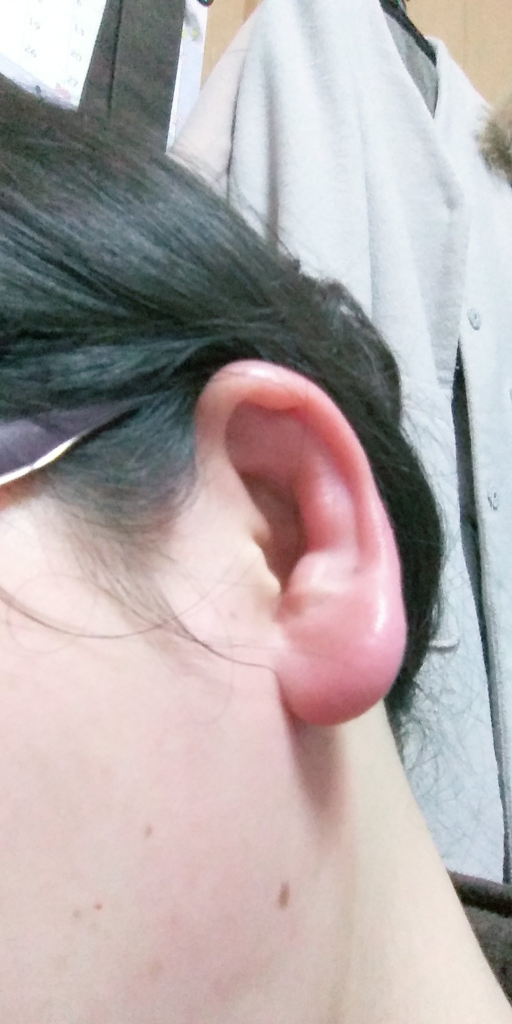 ミーコ 耳掻きのし過ぎか 左耳が熱もってすっごい腫れた それに伴い リンパ腺と頭も痛い 38度の発熱 とりあえず 耳たぶを冷えピタでおおって アイスノンもした 解熱剤は辛くないから自己免疫力を信じて飲まずに寝ます 明日は仕事休めないから ミーコ 耳掻きのし過ぎか 左耳が熱もってすっごい腫れた それに伴い リンパ腺と頭も痛い 38度の発熱 とりあえず 耳たぶを冷えピタでおおって アイスノンもした 解熱剤は辛くないから自己免疫力を信じて飲まずに寝ます 明日は仕事休めないから