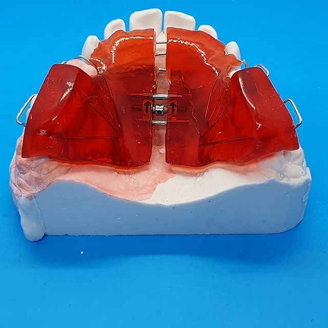 A shining red upper twin block that left the lab today! Getting ready for #valentinesday2020 ❤ 
#orthodontic #teeth #twinblock #dentistry #dentist #red #orthodontics #laboratory #laboratorylife ift.tt/2UH1umH
