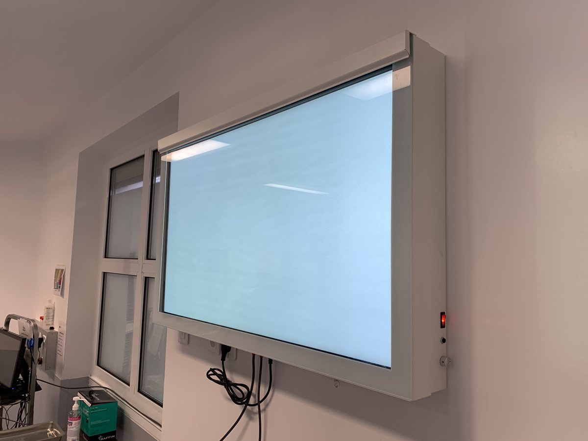 Negatoscreen1's tweet photo. Encore une belle installation de #Negatoscreen Bloc à #Caen !
Le #bloc opératoire en (r)évolution #numerique.
https://t.co/RQq4b20ES5 https://t.co/H49rSdVrVs