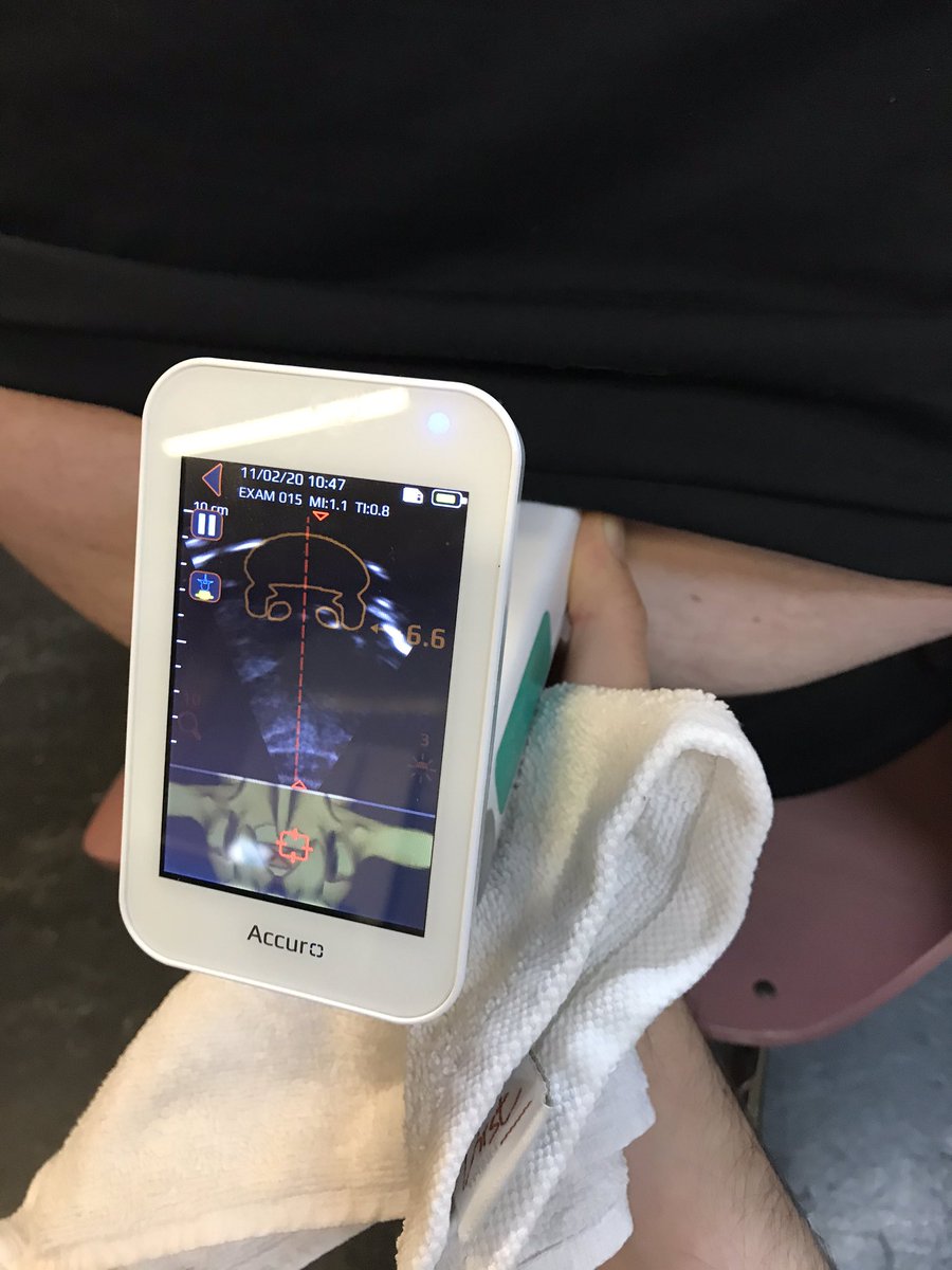 NOTILLariboisi1's tweet image. A la matinale de l’innovation, votre péridurale ou votre PL difficile en un clin d’œil avec l’Accuro ! Appareil d’écho simple d’utilisation #ledX #limX