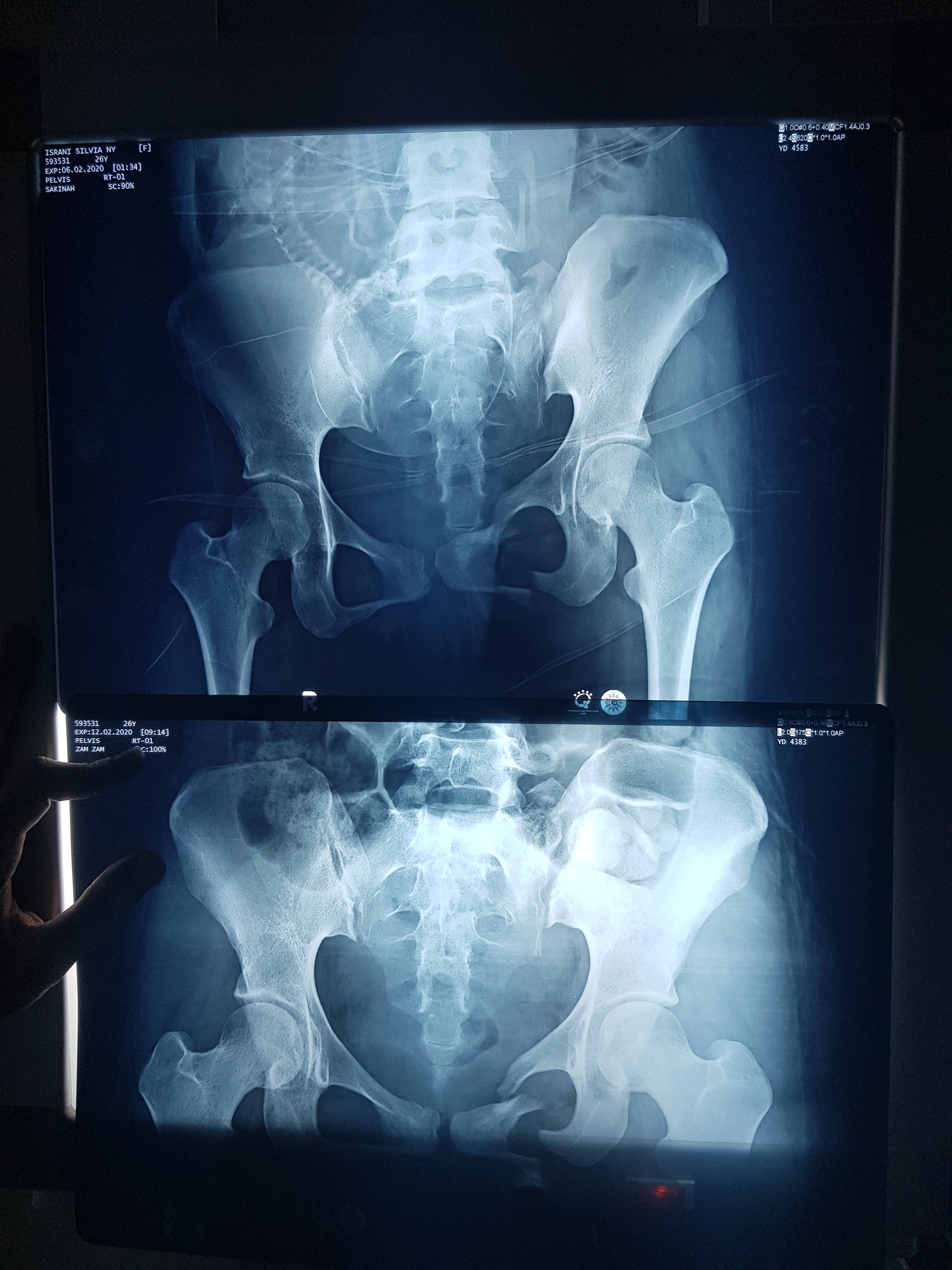 Plyajlarda yalangochlik deoda porno