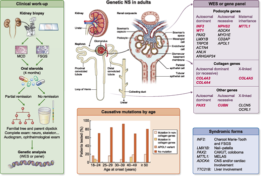 The #genetics of steroid-resistant #nephroticsyndrome in adults. buff.ly/2uuYIXh