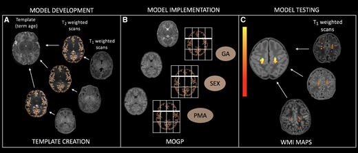 Can you see what I see? Assessing brain maturation and injury in preterm and term neonates. New scientific commentary by Duerden and Thompson bit.ly/37kx6Bp