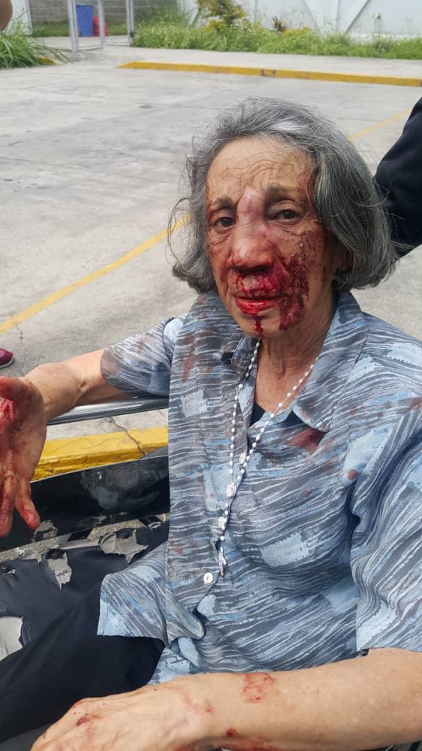 ElaFerris's tweet photo. El comedor en Los Teques "Comunidad María Auxiliadora Madre de Dios", tuvo que suspender sus actividades por la agresión a la que fueron sometidos por malandros criminales. Así golpearon a la coordinadora del comedor que servía 400 platos de comida diarios a los ms necesitados. https://t.co/7gyPtWd7Wl