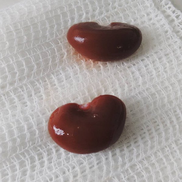 anatomiae_'s tweet image. A frase "os rins parecem feijões" nunca fez tanto sentido como nesta foto 😂