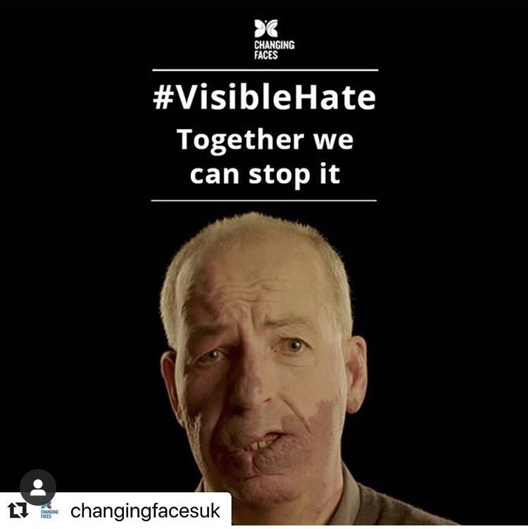 connectmed's tweet photo. New research from a survey by Changing Faces found that 1 in 3 people with a facial deformity have experienced abuse in the street. 72% of those people did not report it. We stand with @changingfacesuk as they campaign to end #VisibleHate. https://t.co/dNm7kl9v7L
