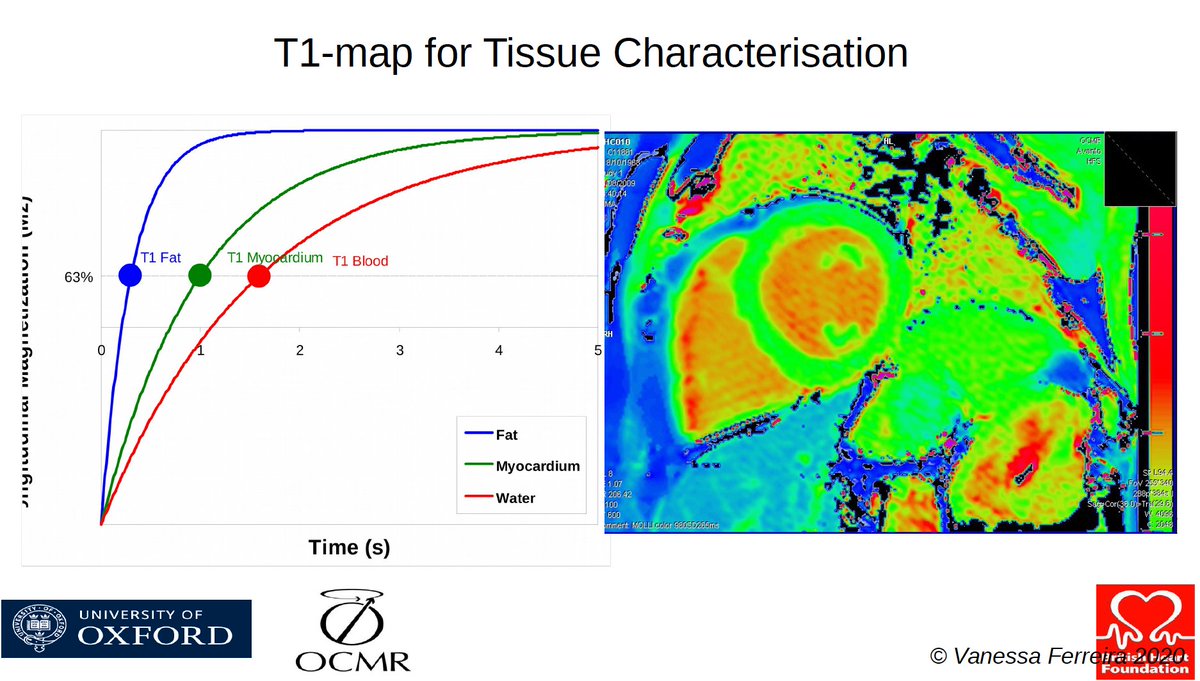 purviparwani's tweet photo. Great talk by Vanessa Ferreira on T1,T2 mapping 

-> Increased T1 value on myocardial disease 
-> Decreased T1 value on Fabry's disease 
Detection of high T1 can be before LGE sets 

#whyCMR 
#SCMR2020
#cvimaging https://t.co/ek41sANWa1