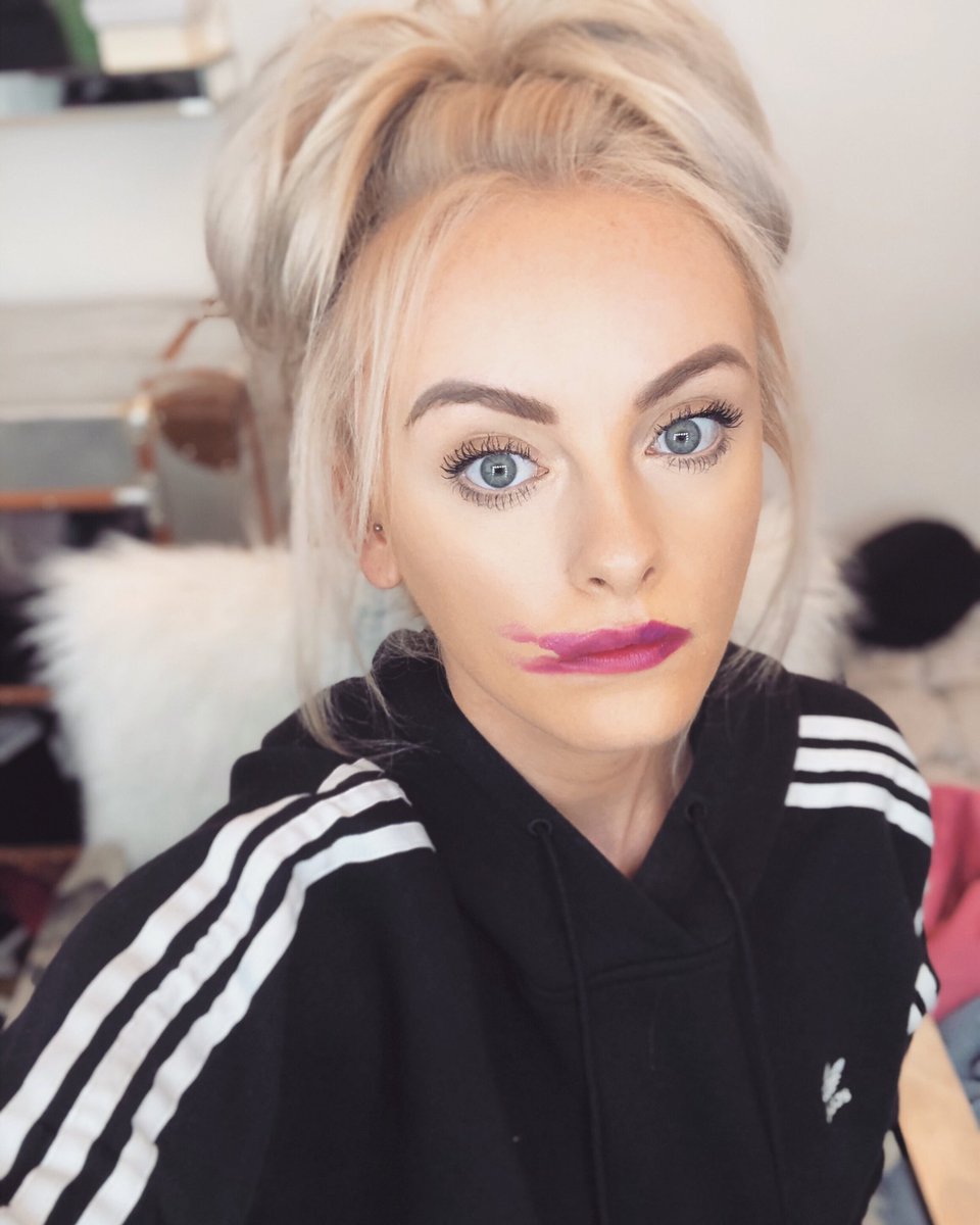 KatiexMcGlynn's tweet photo. ATTENTION 💋 this is a reminder for all you beautiful ladies to go for your smears! I know it’s not the most comfortable sitch to endure BUT 5 minutes of awkwardness (with a qualified nurse who’s seen it all before) could potentially save your life💗#SmearCampaign #CervicalCancer https://t.co/gnmHPl2u7A