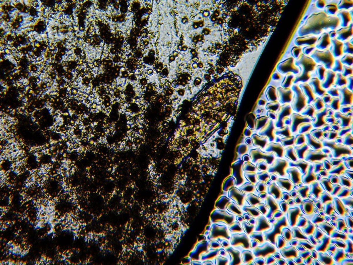 anglonerd's tweet image. My #Rotifer Of The Week choice is this little guy who squished himself down between some mold and the edge of the world (aka the end of the slide). #slide #science #organism #mold #micro