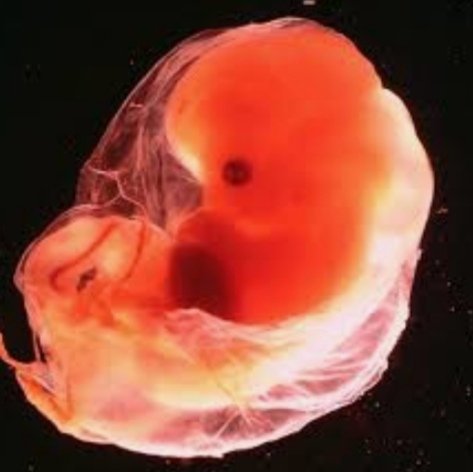 Зародыш фотографии 6. Зародыш фотографии 6. Зародыш фотографии 6. 6 недель беременности фото. Зародыш фотографии 6.