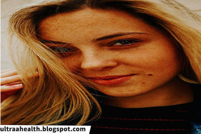 UltraaHealth's tweet image. How To deal with Your Acne Condition On a private Level ?
whareotiv.com/2DCd

#health #healthofthenation #healthy