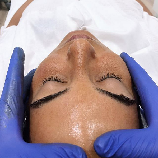 Tienes #MELASMA? Es considerado una enfermedad crónica. La PREVENCIÓN con fotoprotectores tópicos y orales, planes despigmentantes, ácido tranexámico, junto con algunos láseres específicos forman parte de una rutina que nos ayuda a hacerlo lo más discreto posible
#clinicamorano
