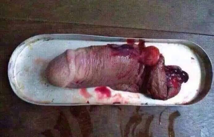 penis gore  / X