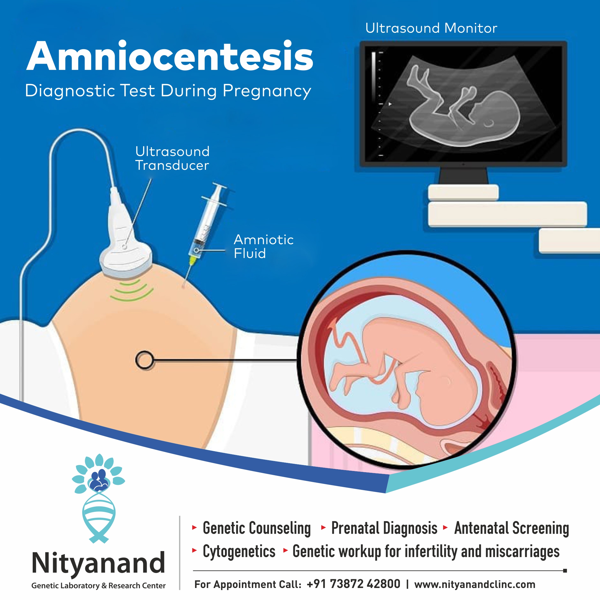 Amniocentesis Diagram