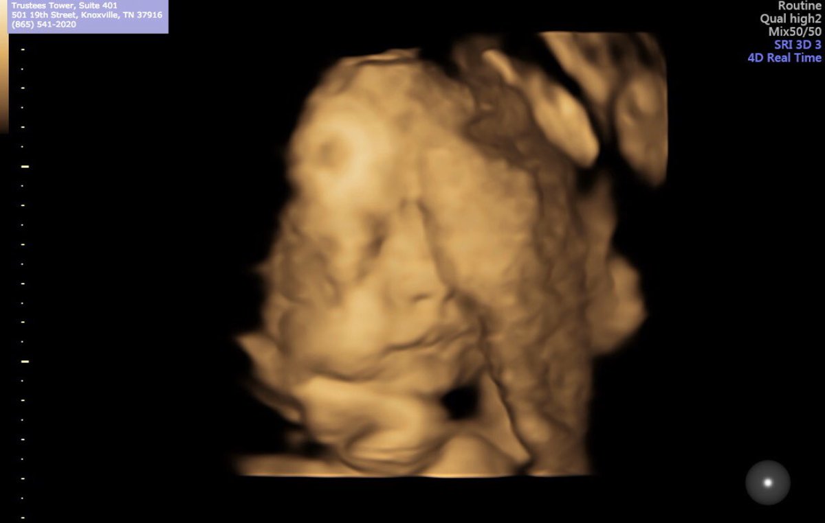 Those lips 😍😍😍