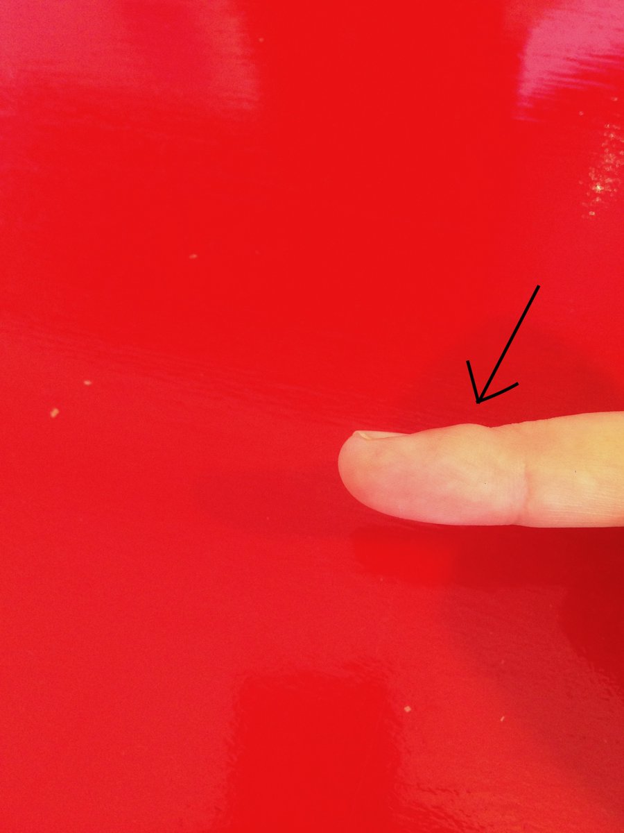 Nathanael O Reilly On Twitter Yep Still Got My Writer S Bump Or Liar S Lump On The Middle Finger Of My Right Hand I Don T Write By Hand Anywhere Near As Much As I