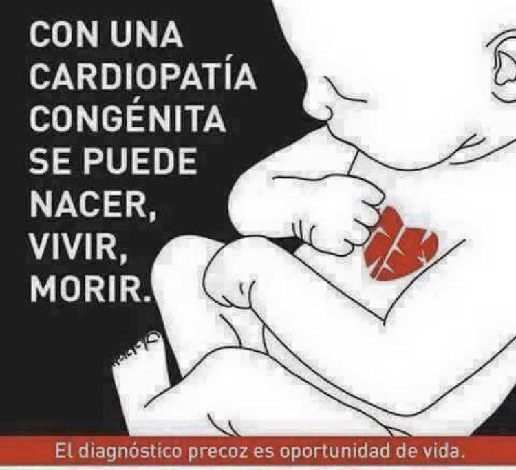 #DiaMundialdelasCardiopatiasCongenitas