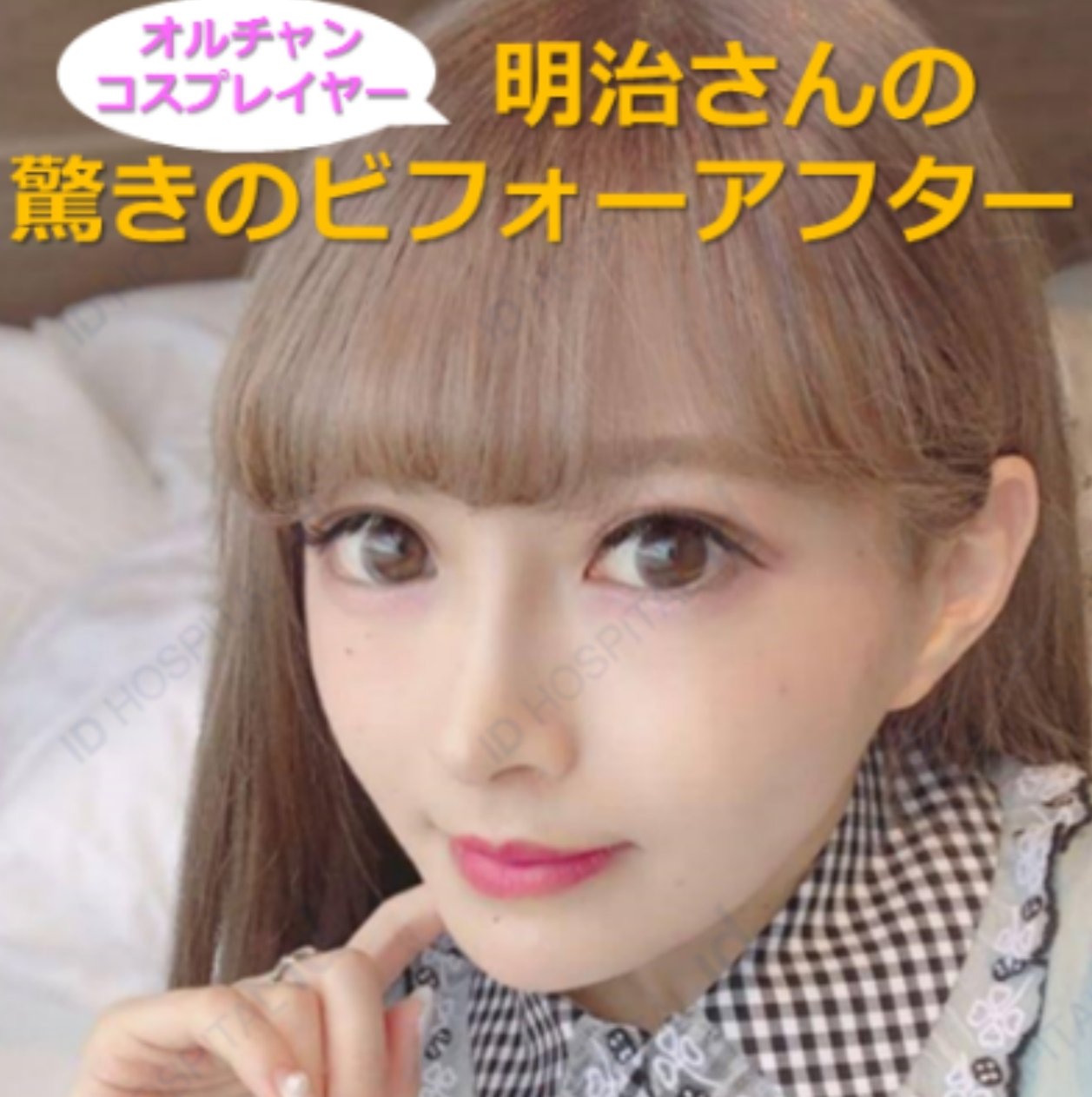 受け口手術 Twitter Search Twitter