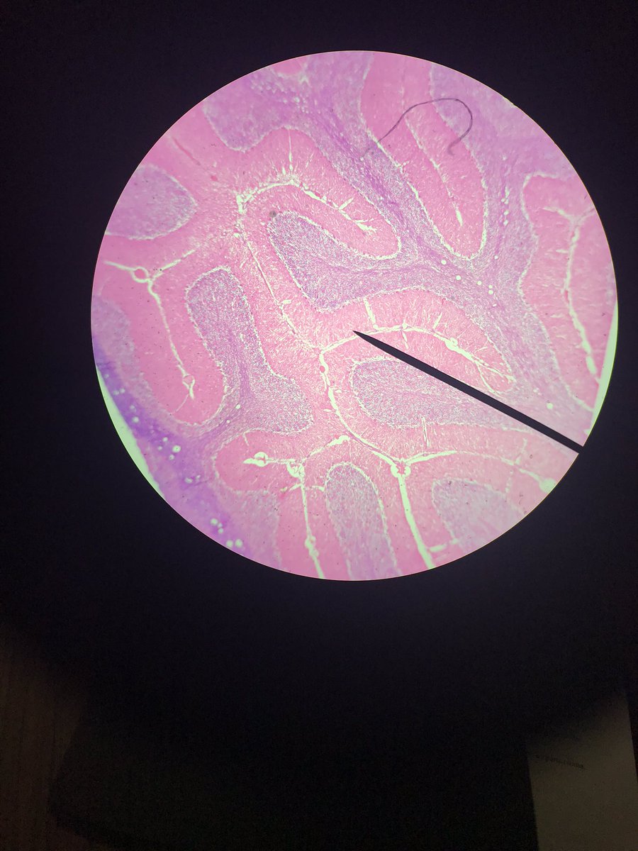Spooky_TravelsD's tweet image. Y’all don’t know how excited I was to look at all these different cell slides
#neurons #brainandbehavior