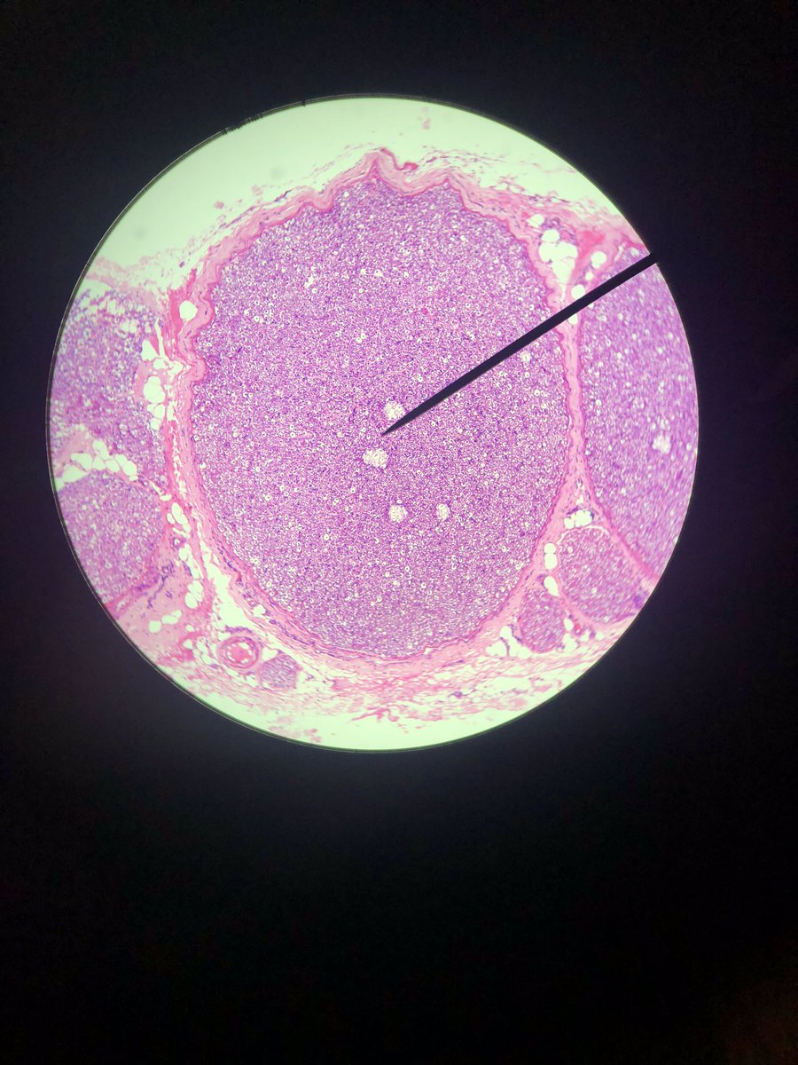 Spooky_TravelsD's tweet image. Y’all don’t know how excited I was to look at all these different cell slides
#neurons #brainandbehavior