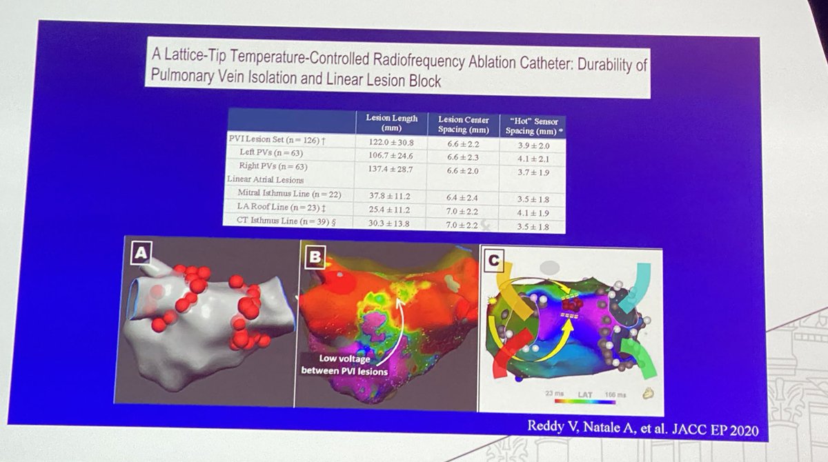 CarinaHardy4's tweet photo. #AFIB2020
@BiosenseWebster 
#EPeeps 

Ultrafast and Very high power ablation @andreanatalemd 
very nice talk https://t.co/kYqregKGbj
