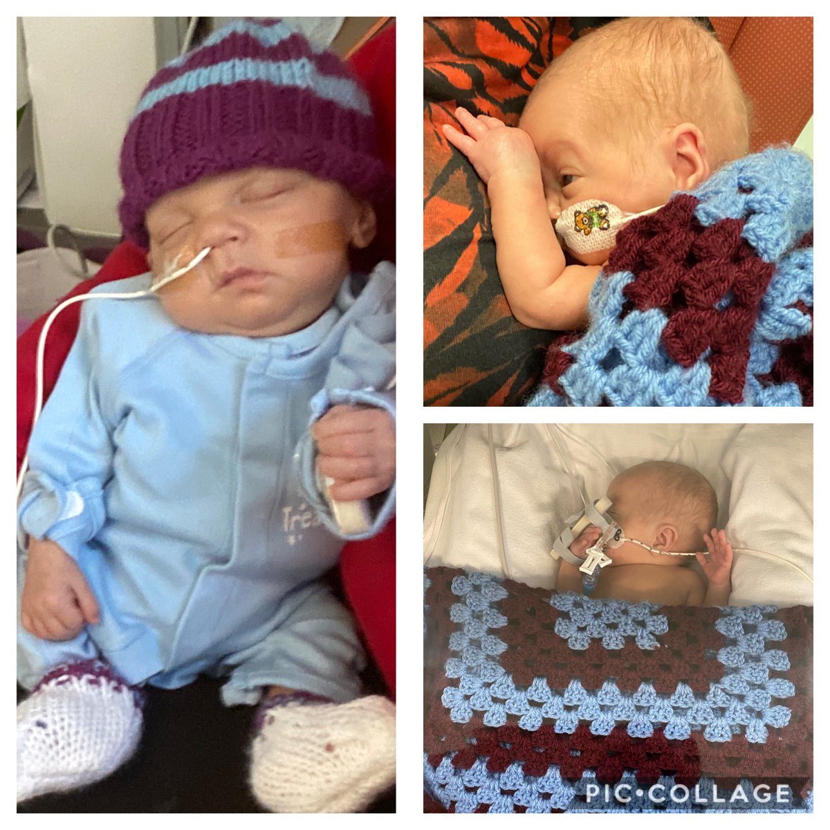 Diane_Compton's tweet photo. @AVFCOfficial Yesterday #BabyHugo was 100 days old. Born at 24weeks weighing 695g, Villa’s tiny fan has come so far... to celebrate 100days we got the nurse, a Blues fan to dress him in his Villa colours 💙 UTV #microprem #fighter #villa #AVFC #uhcw https://t.co/PjuncHssHm