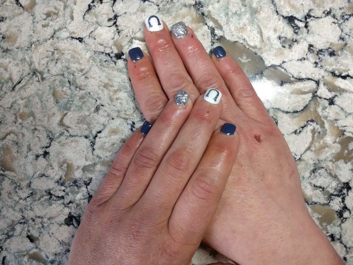 JHaberleyWTOV9's tweet image. Nails before and after #magicmakeover #NEWS9 @WTOV9
