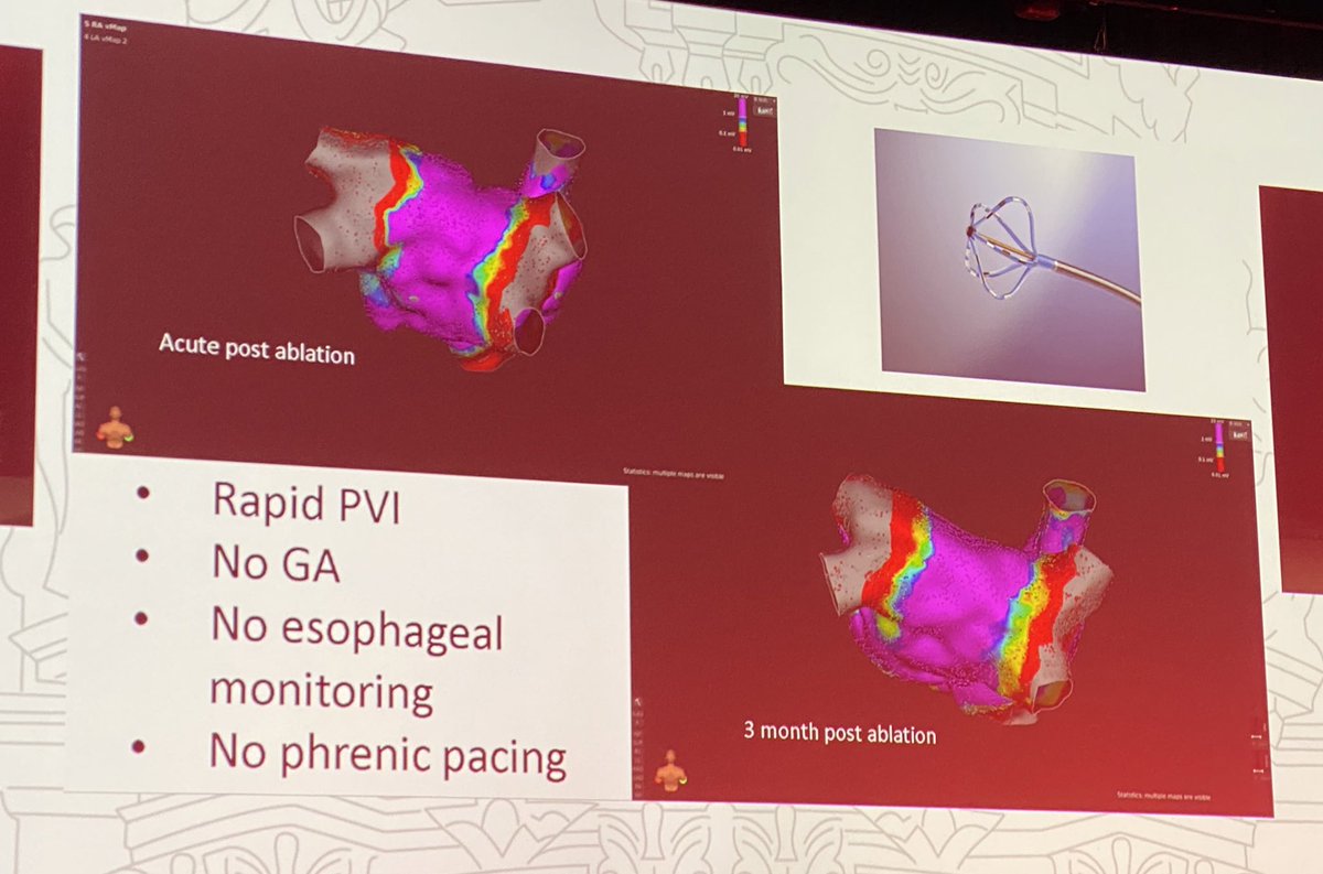 CarinaHardy4's tweet photo. #AFIB2020
@BiosenseWebster 
#EPeeps 

Electroporation vs HPSD 
Excellent talk @PierreJais https://t.co/vyIzz8y4Yk