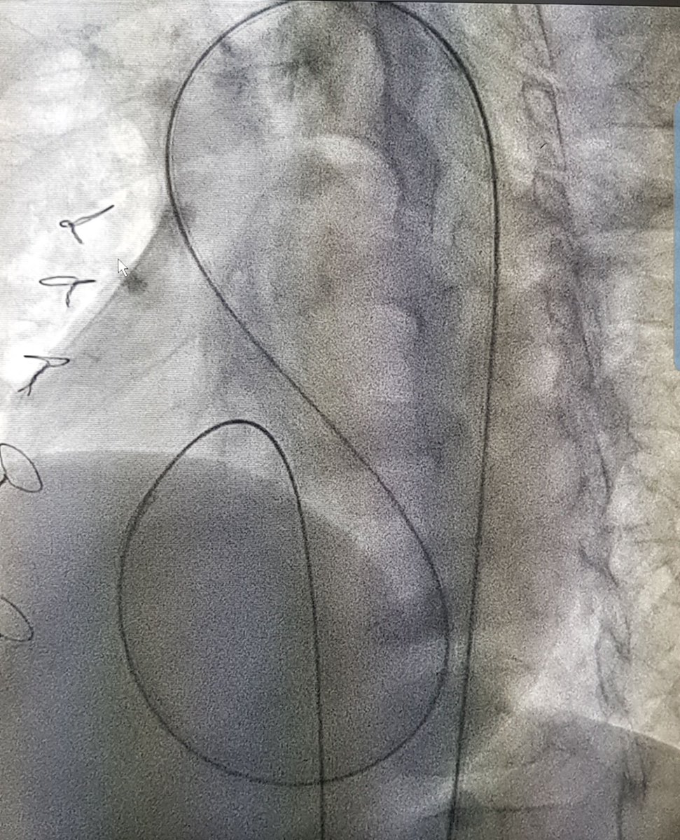 drgianma's tweet photo. 14 de Febrero 
Día mundial de las Cardiopatías Congénitas
#congenital
#congenitalheart
#catdiotwitter https://t.co/ZuDTpQKXTa