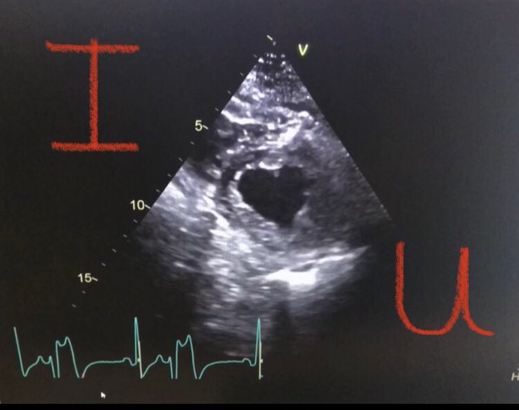 lizziewolfe's tweet photo. ❤️Happy Valentine’s Day Everyone!❤️
#echo #EchoFirst #EchoPhysiologist #ValentinesDay #love #cardiology https://t.co/NVY0UyZlB9