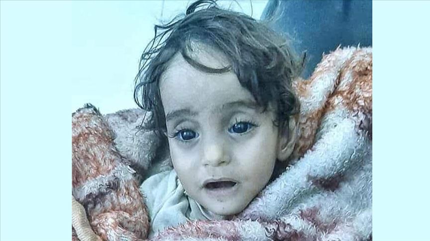 Şuan sıcak yataklarda Sefa sürerken; masumiyet timsali çocuklardan biri olan iman bebek donarak zulüme, acıya, veda etti.Oysaki neydi o ayet ;Müminler ancak Kardeştir.Kardeşinizin ölümüne sessiz kalan vicdanınızla başbaşa bir gece diliyorum