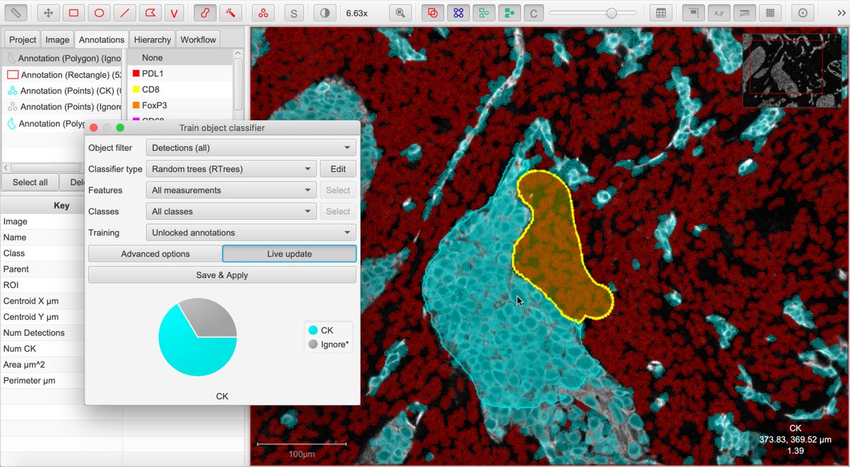 petebankhead's tweet image. @QuPath v0.2.0-m9 is now available at qupath.github.io - lots of new things in this release, including entirely rewritten object classifiers, new commands, and many improvements for fluorescence &amp;amp; multiplexed analysis 

#opensource #bioimageanalysis #digitalpathology