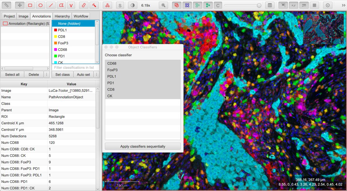 petebankhead's tweet image. @QuPath v0.2.0-m9 is now available at qupath.github.io - lots of new things in this release, including entirely rewritten object classifiers, new commands, and many improvements for fluorescence &amp;amp; multiplexed analysis 

#opensource #bioimageanalysis #digitalpathology