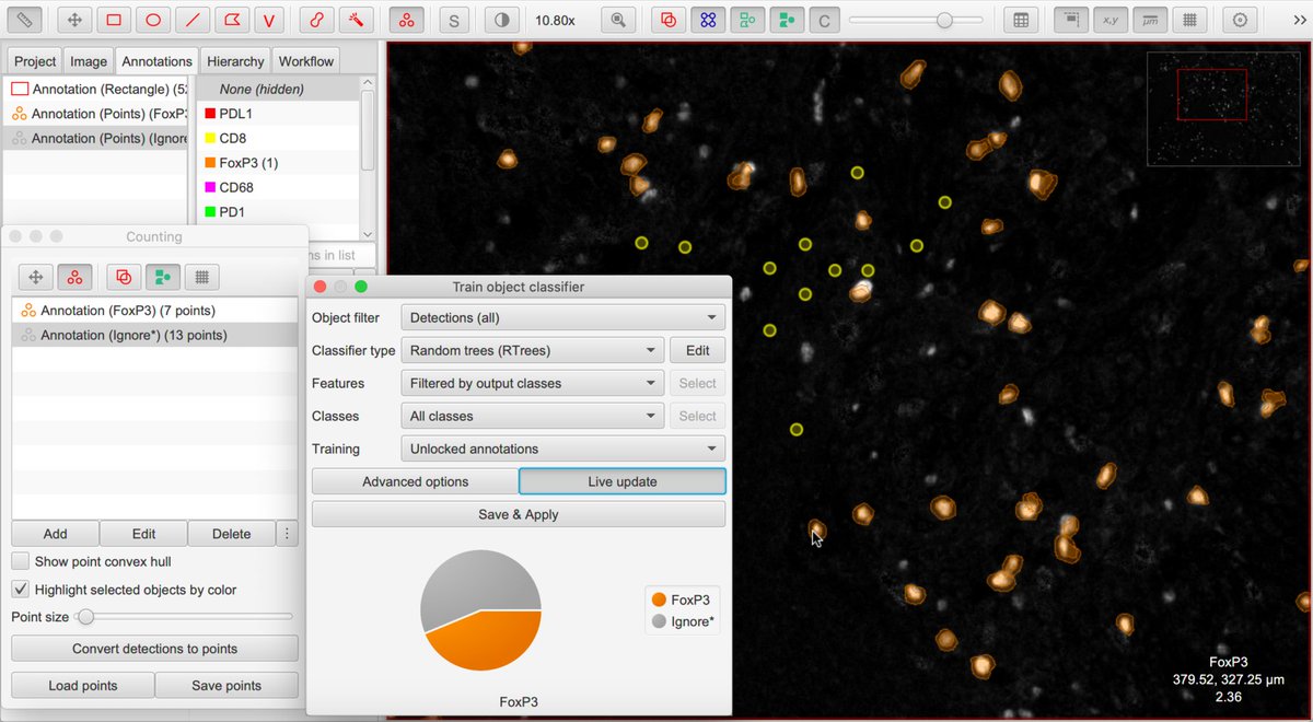 petebankhead's tweet image. @QuPath v0.2.0-m9 is now available at qupath.github.io - lots of new things in this release, including entirely rewritten object classifiers, new commands, and many improvements for fluorescence &amp;amp; multiplexed analysis 

#opensource #bioimageanalysis #digitalpathology