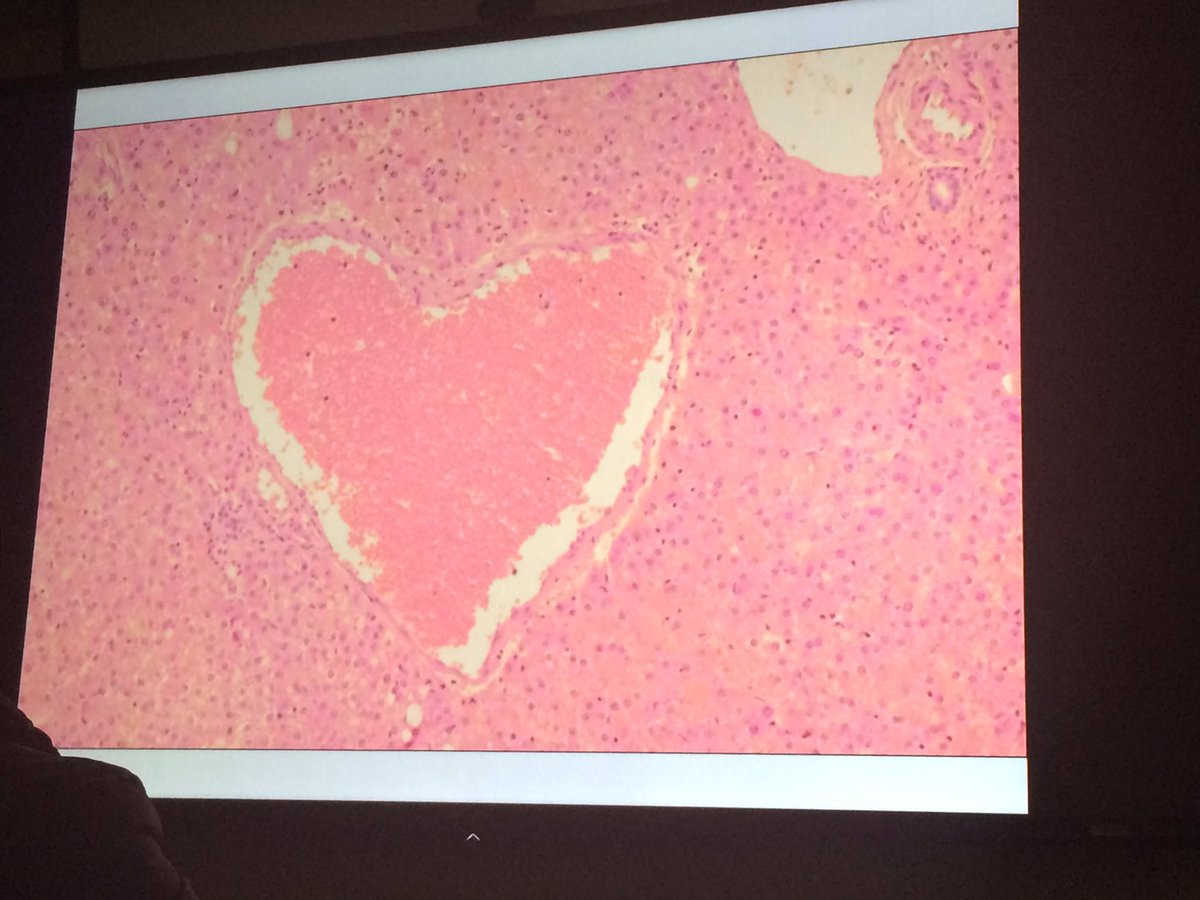 Happy Valentine's Day from our Liver Pathology Conference! ❤️