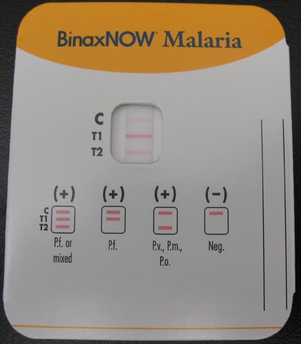 Малярия тестирование. Тест binax Now malaria. Malaria Rapid Diagnostic Test. Malaria Rapid Diagnostic Test (RDTS. Rapid Assessment of malaria.