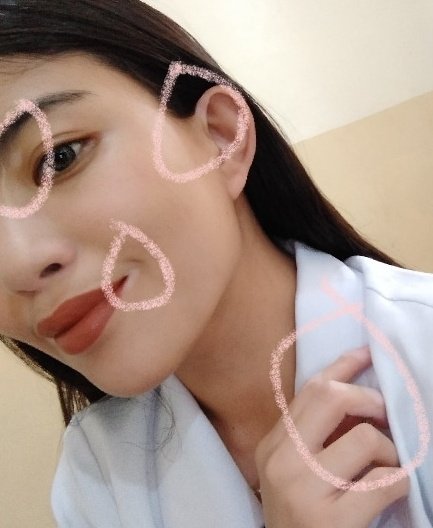 ClumsyKaycee's tweet photo. This has been my biggest insecurity  &amp; I'm done trying to hide it, I'm done hating my own skin. So, Hi! This is my skin w/o any filter. I suffer from a skin cond. called vitiligo and if you're disgusted, disturbed or uncomfortable looking at me, pls. do me a favor &amp; block me 😊-- https://t.co/hjgJIXMQna