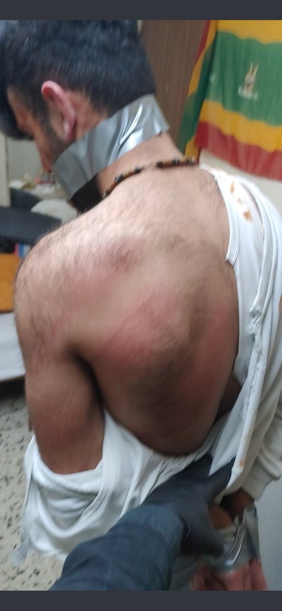 hiçbir öncesi sonrası fotoğrafı bu kadar mutlu etmemişti