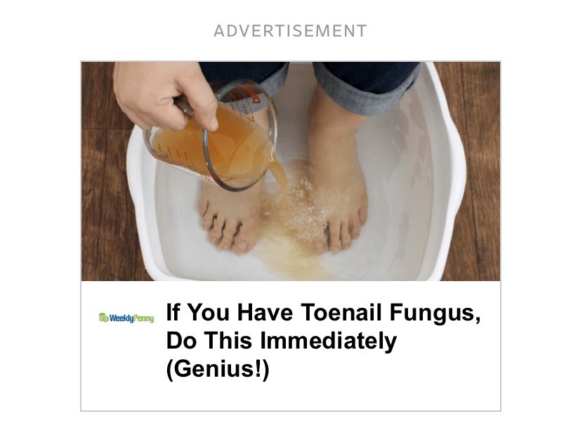 TalentTime's tweet photo. What big Pharma doesn’t want you to know is you can cure toenail fungus by buying tix to Thursday’s Talent Time

MARCH 5th @RioTheatre #TRUTHCONVENTION w/@ryanbeil @KristyAudette @AllieEnt @freakdream9 @capri_everitt @andreahjin Flat Earth band &amp; more!

https://t.co/iy1Vlb0yVQ https://t.co/M6aLVZ1lnQ